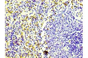 IHC image of ABIN7127275 diluted at 1:100 and staining in paraffin-embedded human spleen tissue performed on a Leica BondTM system. (Recombinant CD163 antibody)
