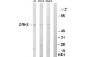Western blot analysis of extracts from Jurkat/COLO205/HuvEc cells, using GRK6 Antibody. (GRK6 antibody  (AA 10-59))