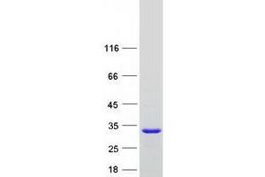 Validation with Western Blot (RABL3 Protein (Myc-DYKDDDDK Tag))