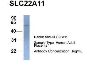Host:  Rabbit  Target Name:  SLC22A11  Sample Type:  Human Adult Placenta  Antibody Dilution:  1. (SLC22A11 antibody  (C-Term))