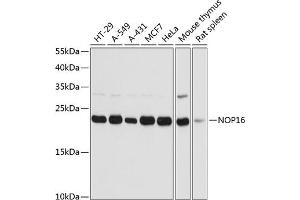 Western blot analysis of extracts of various cell lines, using NOP16 antibody  at 1:3000 dilution. (NOP16 antibody  (AA 1-178))