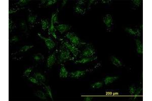 Image no. 3 for anti-Cofilin 2 (CFL2) (AA 57-167) antibody (ABIN598607) (Cofilin 2 antibody  (AA 57-167))