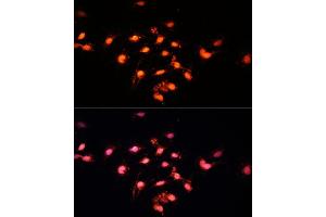 Immunofluorescence analysis of C6 cells using GTF3C4 Polyclonal Antibody  at dilution of 1:100 (40x lens). (GTF3C4 antibody  (AA 583-822))