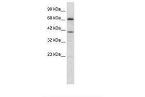 Image no. 2 for anti-PR Domain Containing 14 (PRDM14) (AA 208-257) antibody (ABIN202775) (PRDM14 antibody  (AA 208-257))