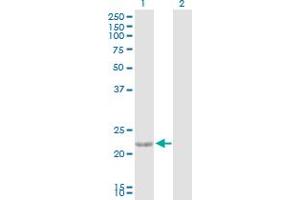 Western Blot analysis of CTF1 expression in transfected 293T cell line by CTF1 MaxPab polyclonal antibody. (Cardiotrophin 1 antibody  (AA 1-201))