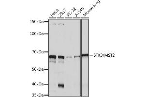 Western blot analysis of extracts of various cell lines, using STK3/MST2 Rabbit mAb (ABIN7270223) at 1:1000 dilution. (STK3 antibody)