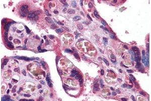 Human Placenta: Formalin-Fixed, Paraffin-Embedded (FFPE)