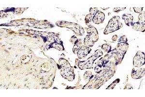 Detection of NEU in Human Placenta Tissue using Polyclonal Antibody to Neuraminidase (NEU) (NEU1 antibody  (AA 47-415))
