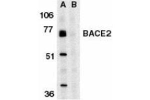 Western blot analysis of BACE2 in human heart tissue lysate in the absence (A) or presence (B) of blocking peptide with AP30113PU-N BACE2 antibody at 1 μg/ml.