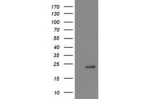 Western Blotting (WB) image for anti-NADH Dehydrogenase (Ubiquinone) 1 beta Subcomplex, 9, 22kDa (NDUFB9) (AA 3-179) antibody (ABIN1491362)