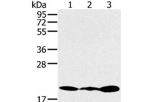 Western Blot analysis of Jurkat, 231 and K562 cell using RNF5 Polyclonal Antibody at dilution of 1:200 (RNF5 antibody)