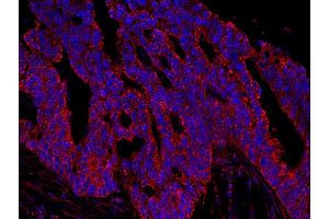 Immunofluorescence (IF) image for anti-A Kinase (PRKA) Anchor Protein 1 (AKAP1) (AA 375-425) antibody (ABIN7448928)