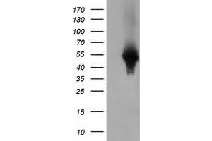 Western Blotting (WB) image for anti-Haptoglobin (HP) antibody (ABIN1498579)
