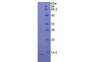 Image no. 1 for S100 Calcium Binding Protein B (S100B) (AA 1-92) (Active) protein (His tag) (ABIN6239831)