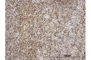 Immunoperoxidase of monoclonal antibody to TNKS on formalin-fixed paraffin-embedded human lymph node. (TNKS antibody  (AA 1017-1124))