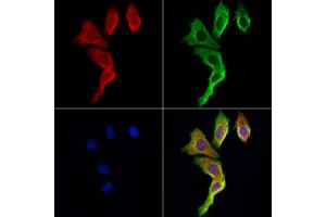 ABIN6265740 and ABIN6273021 staining Hela cells by IF/ICC.