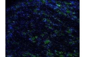 Expression of TRPV1 in rat DRG - Immunohistochemical staining of rat dorsal root ganglion (DRG) frozen sections using Anti-Rat TRPV1 (VR1) (extracellular )-ATTO Fluor-488 Antibody (ABIN7043839), (1:50), (green). (TRPV1 antibody  (Cys616Ser-Mutant, Extracellular) (Atto 488))