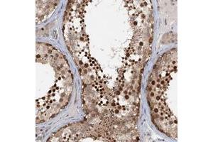 Immunohistochemical staining of human testis with TAS2R42 polyclonal antibody  shows strong nuclear positivity in cells of seminiferus ducts at 1:50-1:200 dilution. (TAS2R42 antibody)