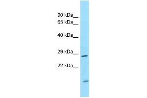 WB Suggested Anti-CD82 Antibody Titration: 1. (CD82 antibody  (Middle Region))