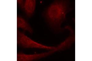 Immunofluorescence (IF) image for anti-Nuclear Factor-kB p65 (NFkBP65) (pSer529) antibody (ABIN1870581) (NF-kB p65 antibody  (pSer529))