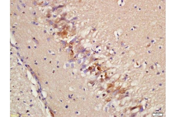 RAPGEF4 antibody  (AA 151-250)