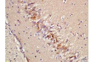 Formalin-fixed and paraffin embedded rat brain labeled with Rabbit Anti-Epac2 Polyclonal Antibody, Unconjugated (ABIN2173847) at 1:200 followed by conjugation to the secondary antibody and DAB staining
