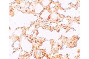 Immunohistochemical staining of mouse lung cells with SLC39A6 polyclonal antibody  at 5 ug/mL. (SLC39A6 antibody  (Internal Region))