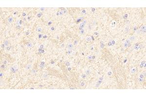 Detection of SIRT2 in Mouse Cerebrum Tissue using Polyclonal Antibody to Sirtuin 2 (SIRT2) (SIRT2 antibody  (AA 65-340))