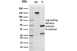 SDS-PAGE Analysis Purified G-CSF Recombinant Mouse Monoclonal Antibody (rCSF3/900). (Recombinant G-CSF antibody)