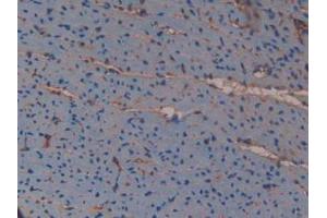 Figure. (Versican antibody  (AA 3058-3299))