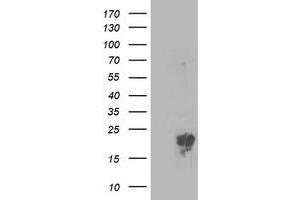 Western Blotting (WB) image for anti-Phosphomevalonate Kinase (PMVK) antibody (ABIN1500302) (PMVK antibody)