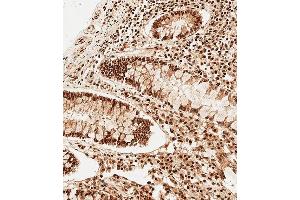 Immunohistochemical analysis of paraffin-embedded Human colon tissue using A performed on the Leica® BOND RXm. (SNRPD3 antibody  (N-Term))