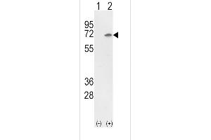 Western blot analysis of Ku70 (arrow) using rabbit polyclonal Ku70 Antibody (Center) (ABIN652244 and ABIN2841008). (XRCC6 antibody  (AA 432-461))