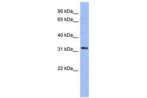 Image no. 1 for anti-T-Cell Leukemia Homeobox 1 (TLX1) (N-Term) antibody (ABIN6742786) (TLX1 antibody  (N-Term))