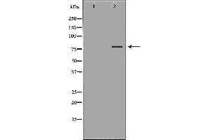 Western blot analysis of lung  lysate using TICAM1 antibody. (TICAM1 antibody  (Internal Region))