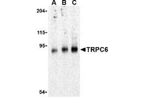 Western Blotting (WB) image for anti-Transient Receptor Potential Cation Channel, Subfamily C, Member 6 (TRPC6) (C-Term) antibody (ABIN1030779) (TRPC6 antibody  (C-Term))