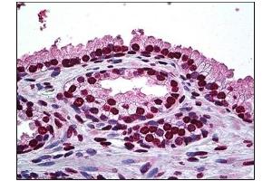 Immunohistochemistry (IHC) image for anti-Distal-Less Homeobox Protein 2 (DLX2) antibody (ABIN781967) (DLX2 antibody)