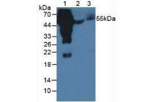 Western blot analysis of (1) Human Serum, (2) Porcine Serum and (3) Mouse Serum. (Rabbit anti-Human IgG4 (AA 222-327) Antibody)