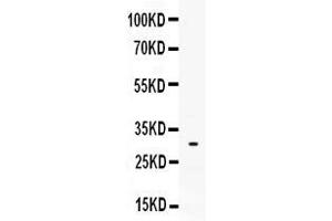 Western blot analysis of Mast Cell Tryptase expression in 293T whole cell lysates ( Lane 1). (TPSAB1 antibody  (AA 65-275))