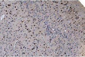 IHC analysis of GABARAP using anti-GABARAP antibody (ABIN7603159). (GABARAP antibody  (N-Term))
