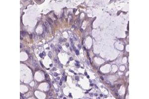 Immunohistochemical analysis of paraffin-embedded Human colon tissue labeling Integrin beta 7 (Integrin beta 7 antibody  (Internal Region))