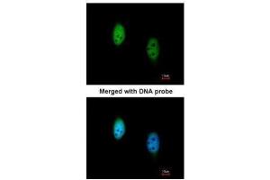 ICC/IF Image Immunofluorescence analysis of paraformaldehyde-fixed HeLa, using TBLR1 , antibody at 1:200 dilution. (TBL1XR1 antibody)