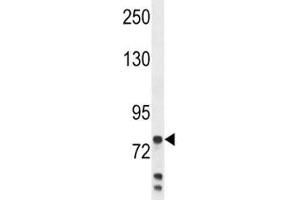 Anti-Myeloperoxidase antibody western blot analysis in MDA-MB231 lysate. (Myeloperoxidase antibody  (AA 420-448))