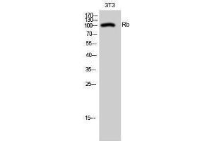 Western Blotting (WB) image for anti-Retinoblastoma 1 (RB1) (Thr638) antibody (ABIN3186700) (Retinoblastoma 1 antibody  (Thr638))