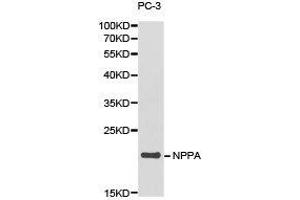 Western Blotting (WB) image for anti-Natriuretic Peptide A (NPPA) antibody (ABIN1873936) (NPPA antibody)