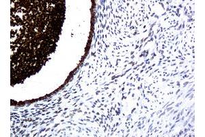 Image no. 1 for anti-WAP Four-Disulfide Core Domain 2 (WFDC2) (AA 31-124) antibody (ABIN1491389) (WFDC2 antibody  (AA 31-124))