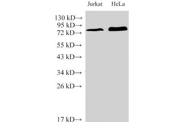 IL-6 Receptor antibody
