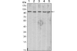 Western blot analysis using CDH2 mouse mAb against A431 (1), NIH/3T3 (2), Hela (3), C6 (4) and LNCap (5) cell lysate. (N-Cadherin antibody)