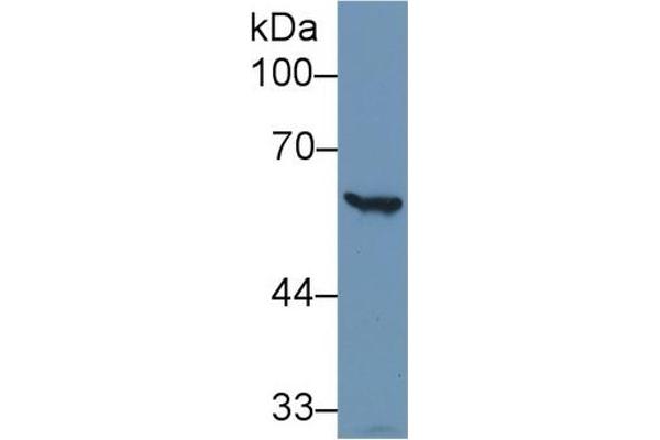 Glucose-6-Phosphate Dehydrogenase antibody