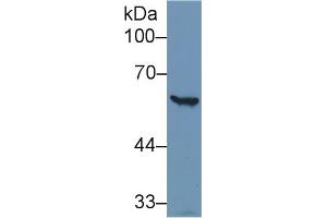 Detection of G6PD in Human Hela cell lysate using Polyclonal Antibody to Glucose-6-phosphate Dehydrogenase (G6PD) (Glucose-6-Phosphate Dehydrogenase antibody)
